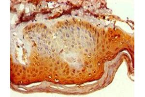 Immunohistochemistry of paraffin-embedded human skin tissue using ABIN7150482 at dilution of 1:100 (POLR1D 抗体  (AA 1-133))