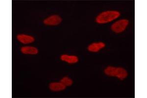 ABIN6267684 staining HT-1080 cells by ICC/IF. (Aurora Kinase B 抗体  (pThr232))