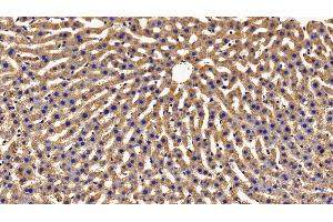 Detection of GHR in Rat Liver Tissue using Polyclonal Antibody to Growth Hormone Receptor (GHR) (Growth Hormone Receptor 抗体  (AA 353-588))