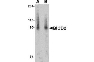 Western Blotting (WB) image for anti-Bicaudal D Homolog 2 (BICD2) (Middle Region) antibody (ABIN1030887) (BICD2 抗体  (Middle Region))