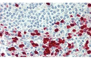Detection of MMP12 in Human Spleen Tissue using Polyclonal Antibody to Matrix Metalloproteinase 12 (MMP12) (MMP12 抗体  (AA 100-286))