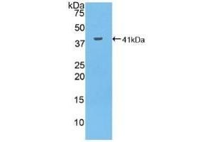 Detection of Recombinant MUC6, Human using Polyclonal Antibody to Mucin 6 (MUC6) (MUC6 抗体  (AA 2338-2439))