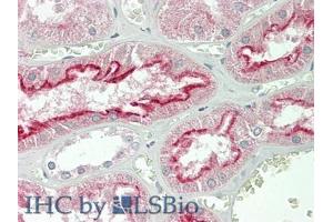 IHC-P analysis of Human Kidney Tissue, with HE staining.