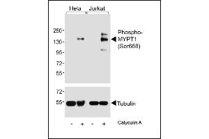 Western blot analysis of lysates from Hela, Jurkat cell line, untreated or treated with Calyculin A, 100nM, using (ABIN6241041 and ABIN6578962) (upper) or Tubulin (lower). (PPP1R12A 抗体  (pSer668))