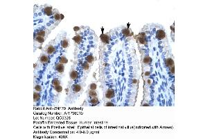 Human Intestine (ZNF70 抗体  (N-Term))