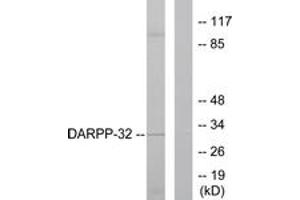 Western blot analysis of extracts from 293 cells, treated with EGF 200ng/ml 30', using DARPP-32 (Ab-75) Antibody. (DARPP32 抗体  (AA 41-90))