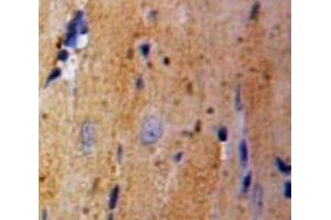 IHC-P analysis of heart tissue, with DAB staining. (GLRX3 抗体  (AA 144-234))