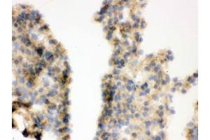 IHC testing of frozen mouse lung tissue with COMT antibody. (COMT 抗体  (AA 52-271))