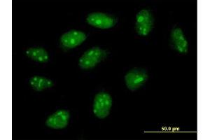 Immunofluorescence of purified MaxPab antibody to FLJ11184 on HeLa cell. (C4orf43 抗体  (AA 1-203))