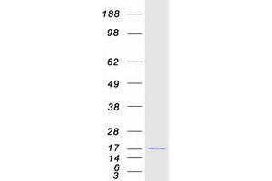 Western Blotting (WB) image for Developmental Pluripotency Associated 5 (DPPA5) protein (Myc-DYKDDDDK Tag) (ABIN2719749)