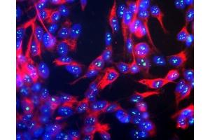Human SH-SY5Y cells stained with ABIN1580417, showing prominent specular nucleolar staining. (Fibrillarin 抗体)