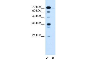 WB Suggested Anti-KLHL31 Antibody Titration:  0. (KLHL31 抗体  (C-Term))