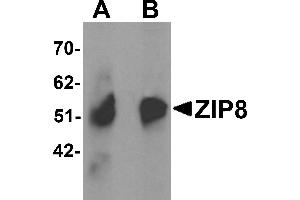 Western Blotting (WB) image for anti-Solute Carrier Family 39 (Zinc Transporter), Member 8 (SLC39A8) (C-Term) antibody (ABIN1030823) (SLC39A8 抗体  (C-Term))
