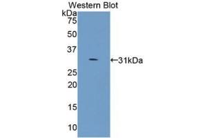 Detection of Recombinant COL4a5, Human using Monoclonal Antibody to Collagen Type IV Alpha 5 (COL4a5) (COL4a5 抗体  (AA 1461-1685))