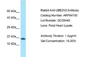 Western Blotting (WB) image for anti-Ubiquitin-Conjugating Enzyme E2 Variant 2 (UBE2V2) (C-Term) antibody (ABIN2774407) (UBE2V2 抗体  (C-Term))