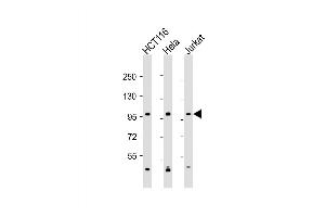 Western Blot at 1:2000 dilution Lane 1: HCT116 whole cell lysate Lane 2: Hela whole cell lysate Lane 3: Jurkat whole cell lysate Lysates/proteins at 20 ug per lane.