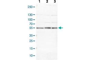 Western blot analysis of Lane 1: NIH-3T3 cell lysate (Mouse embryonic fibroblast cells) Lane 2: NBT-II cell lysate (Rat Wistar bladder tumour cells) with PSMD5 polyclonal antibody  at 1:100-1:500 dilution. (PSMD5 抗体)