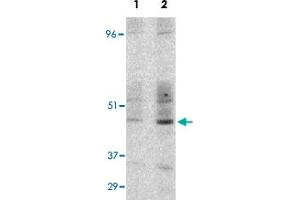 Western blot detection of GST-CD209 fusion protein expressed in E. (DC-SIGN/CD209 抗体  (Internal Region))