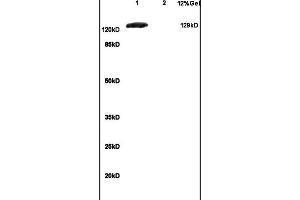 Lane 1: mouse brain lysates Lane 2: mouse embryo lysates probed with Anti GRM1 Polyclonal Antibody, Unconjugated (ABIN734663) at 1:200 in 4 °C. (mGluR1 + mGluR5 抗体  (AA 651-750))