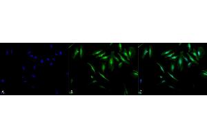 Immunocytochemistry (ICC) image for anti-Crystallin, alpha B (CRYAB) antibody (ABIN361837)