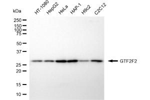 Western blotting analysis using GTF2F2 antibody (ABIN7798708).