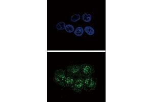 Immunofluorescence (IF) image for anti-Signal Transducer and Activator of Transcription 3 (Acute-Phase Response Factor) (STAT3) (pSer727) antibody (ABIN389664)