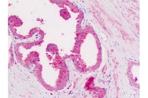 Anti-CD11c antibody IHC of human prostate. (CD11c 抗体  (Internal Region))