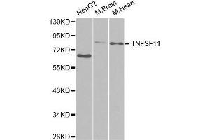 Western blot analysis of extracts of various cell lines, using TNFSF11 antibody. (RANKL 抗体  (AA 78-317))