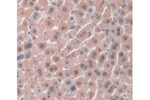 Used in DAB staining on fromalin fixed paraffin- embedded liver tissue (LKB1 抗体  (AA 49-309))