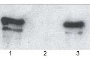 Western blot analysis of wild type p62, GST-tagged (human, recombinant) bound to: (1) glutathione-agarose and (3) ubiquitin-agarose (2: agarose control). (KHDRBS1 抗体  (AA 387-436))