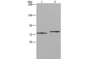 Western Blot analysis of Mouse heart tissue and 231 cell using AATF Polyclonal Antibody at dilution of 1:667 (AATF 抗体)