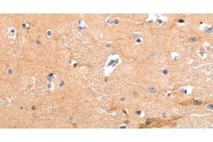 Immunohistochemistry of paraffin-embedded Human brain tissue using GPR64 Polyclonal Antibody at dilution 1:55 (GPR64 抗体)