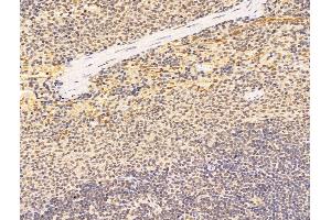 ABIN7094775 and ABIN7098826 at 1/100 staining Rat spleen tissue by IHC-P.