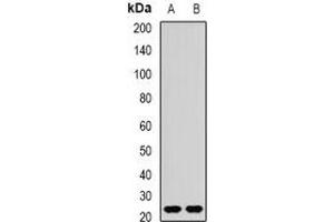 Western blot analysis of REEP1 expression in mouse brain (A), rat brain (B) whole cell lysates. (Receptor Accessory Protein 1 抗体)