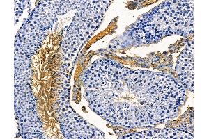 ABIN7094989 and ABIN7099045 at 1/100 staining mouse testis tissue by IHC-P. (RRBP1 抗体)
