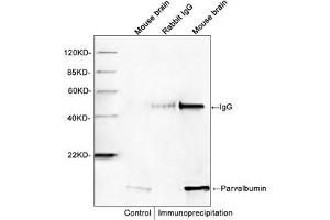 Western blot analysis of immunoprecipitates from mouse brain lysates. (PVALB 抗体)