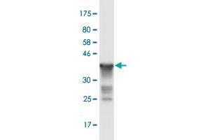 Western Blot detection against Immunogen (36. (RNF20 抗体  (AA 177-276))