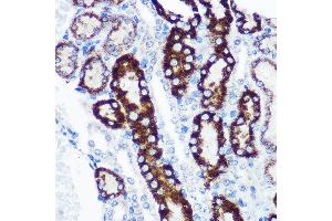 Immunohistochemistry of paraffin-embedded Mouse kidney using FCHSD1 Rabbit pAb (ABIN7270317) at dilution of 1:100 (40x lens). (FCHSD1 抗体  (AA 100-400))