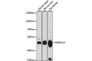 Western blot analysis of extracts of various cell lines, using HMGCS2 antibody (ABIN7265329) at 1:1000 dilution. (HMGCS2 抗体  (AA 269-508))
