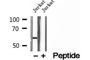 Western blot analysis of extracts of Jurkat cells, using PHGDH antibody. (PHGDH 抗体  (N-Term))