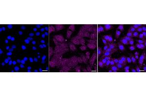 Immunocytochemical staining of HepG2 cells with RAD21 antibody (ABIN7800115), 1:1,000). (Recombinant RAD21 抗体)