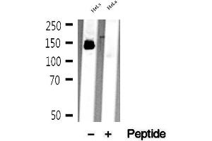 Western blot analysis of extracts of HeLa cells, using mDia1 antibody. (DIAPH1 抗体)