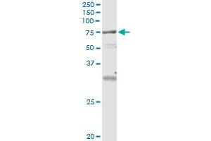 Immunoprecipitation of VPS18 transfected lysate using anti-VPS18 monoclonal antibody and Protein A Magnetic Bead , and immunoblotted with VPS18 MaxPab rabbit polyclonal antibody. (VPS18 抗体  (AA 3-100))