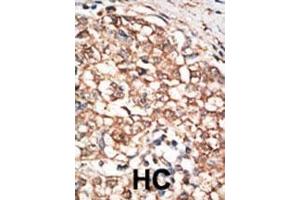 Immunohistochemistry (Paraffin-embedded Sections) (IHC (p)) image for anti-Bone Morphogenetic Protein Receptor, Type IB (BMPR1B) (AA 472-502), (C-Term) antibody (ABIN388739)
