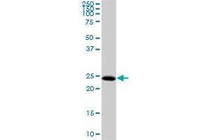 HDHD3 MaxPab polyclonal antibody. (HDHD3 抗体  (AA 1-251))
