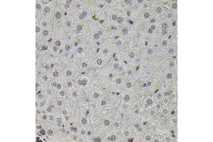 Immunohistochemistry of paraffin-embedded mouse liver using SKP2 antibody (ABIN1874793) at dilution of 1:100 (40x lens). (SKP2 抗体)
