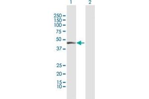 Western Blot analysis of CPA1 expression in transfected 293T cell line by CPA1 MaxPab polyclonal antibody. (CPA1 抗体  (AA 1-419))