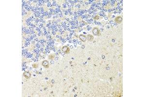 Immunohistochemistry (IHC) image for anti-Neurotrophic Tyrosine Kinase, Receptor, Type 1 (NTRK1) (AA 1-280) antibody (ABIN3022909)