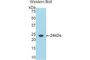 Western blot analysis of the recombinant protein. (Retinol Binding Protein 5 抗体  (AA 19-201))