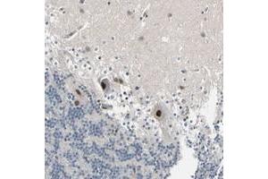 Immunohistochemical staining of human cerebellum with PSMA2 polyclonal antibody  shows strong nuclear positivity in purkinje cells. (PSMA2 抗体)